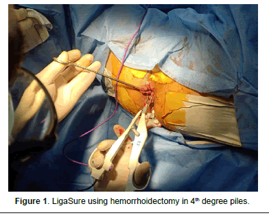 Regenerative-Medicine-hemorrhoidectomy