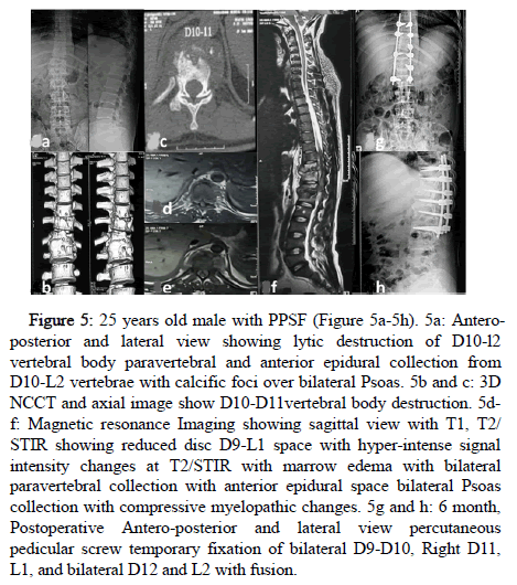 Spine-Anteroposterior-Fluxogram