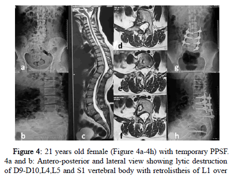 Spine-Neurosurgery-temporary