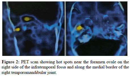 diabetes-research-scan
