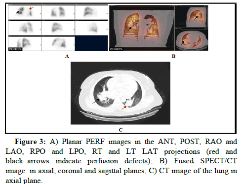 jcer-ANT