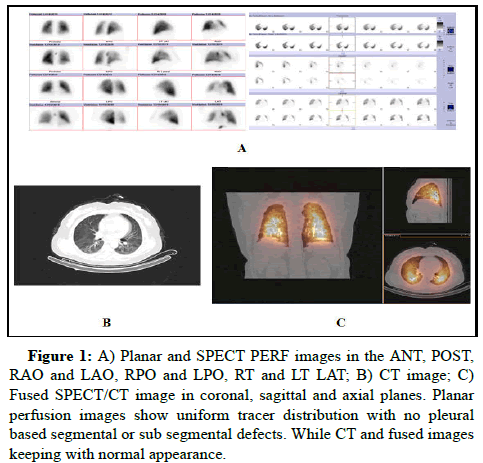 jcer-Planar