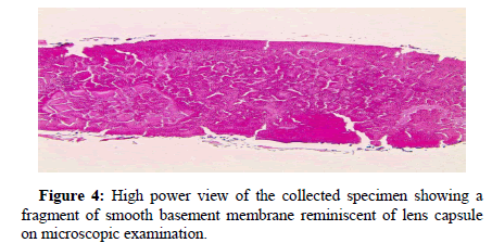 ophthalmic-pathology-power