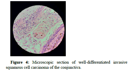 opthalamic-pathology-cell