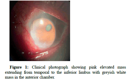 opthalamic-pathology-pink