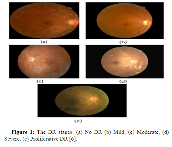 opthalamic-pathology-retina