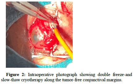 opthalamic-pathology-slow