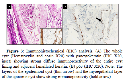 opthmologic-phisiology-keratin