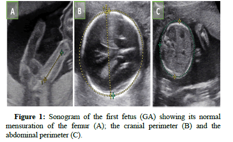 clinical-images-normal