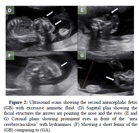 clinical-images-second