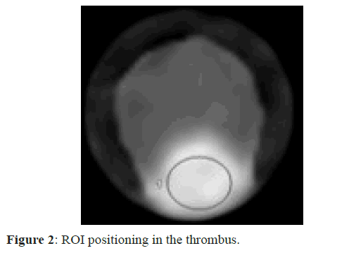 clinical-radiology-throm