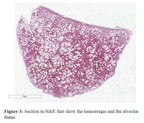 immuno-disease-section