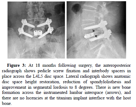 spine-neurosurgery-degree