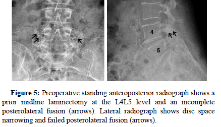 spine-neurosurgery-level