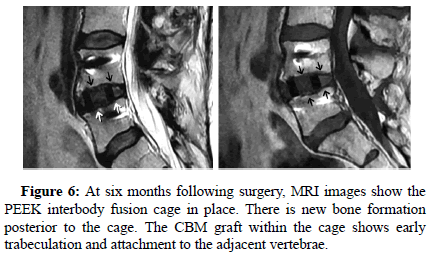 spine-neurosurgery-six