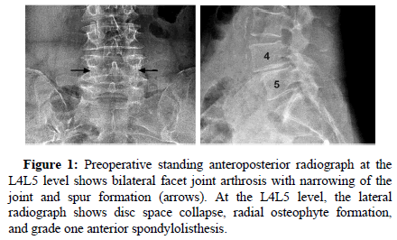 spine-neurosurgery-stand