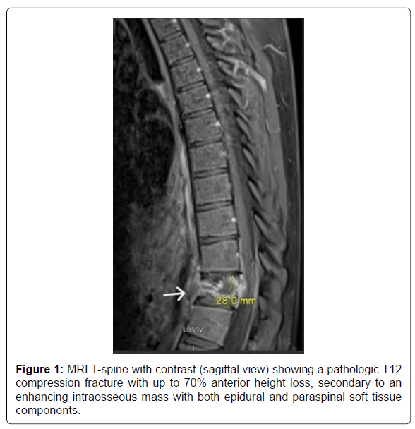 COCR-contrast COCR-contrast