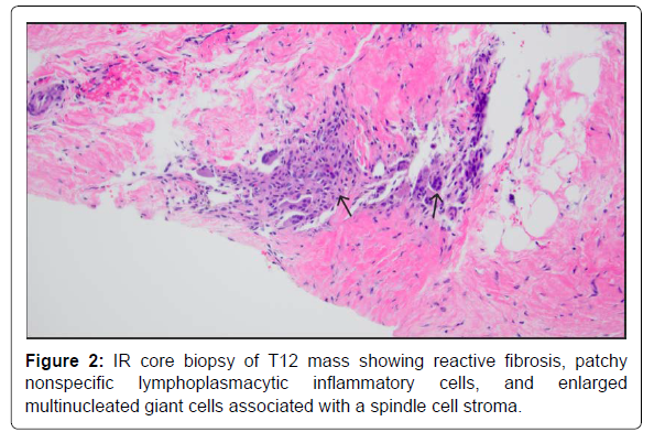 COCR-showing COCR-showing