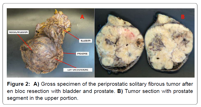 COCR-specimen COCR-specimen