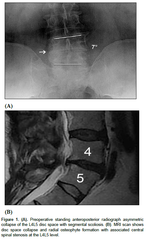 Spine-and-Neurosurgery-Preoperative