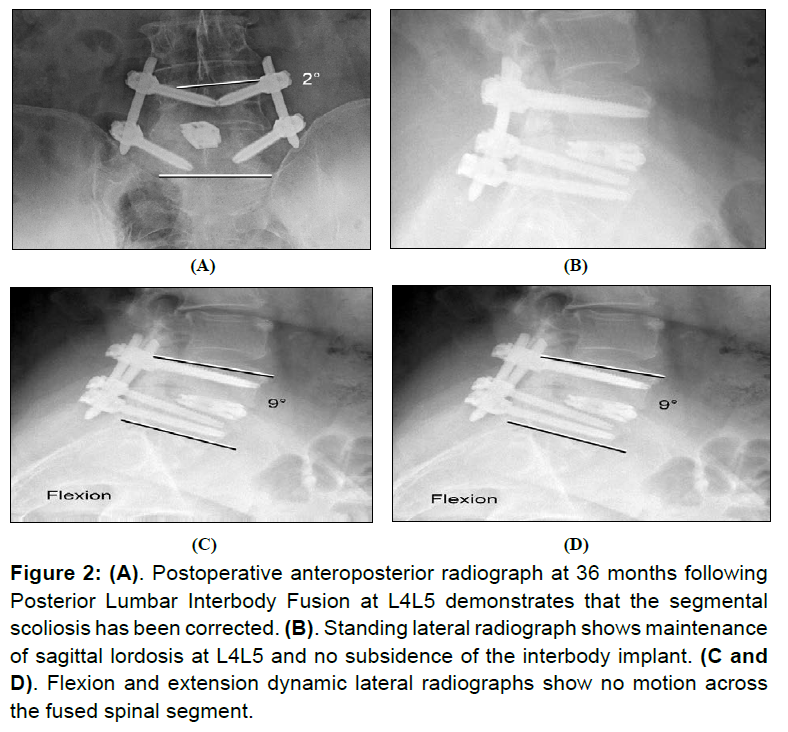 Spine-and-Neurosurgery-anteroposterior