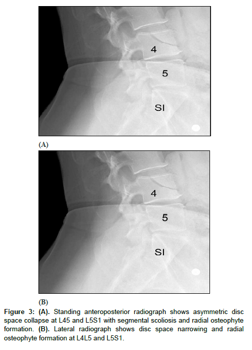 Spine-and-Neurosurgery-radiograph