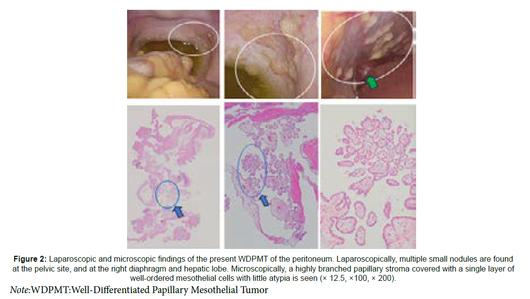clinical-oncology-case-reports-WDPMT