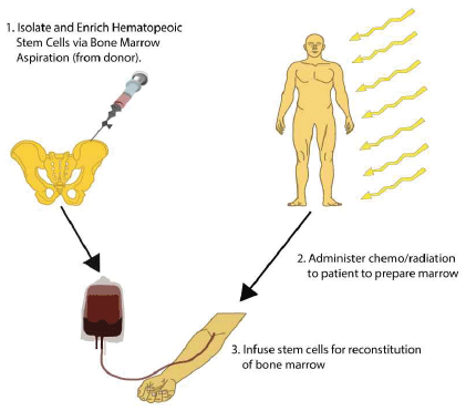 Transplantation