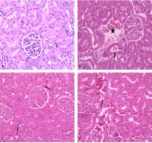 kidney