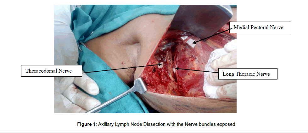 Clinical-Experimental-Axillary-Lymph