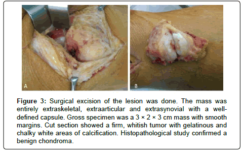 Clinical-Oncology-Surgical-excision