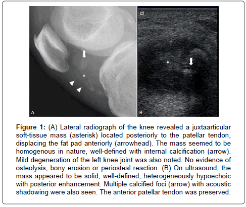 Clinical-Oncology-pad-anteriorly