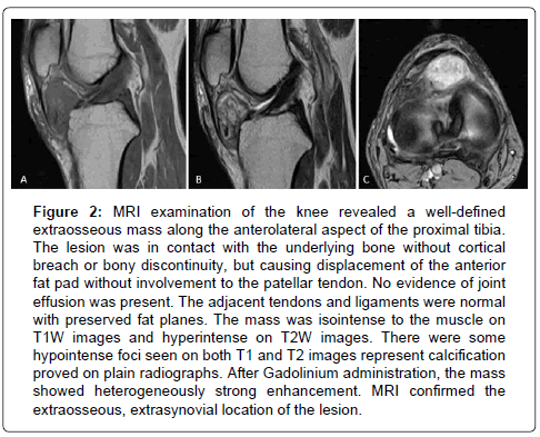 Clinical-Oncology-patellar-tendon