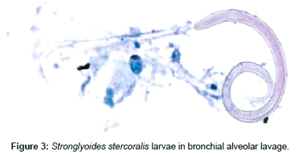 Medical-Microbiology-alveolar-lavage