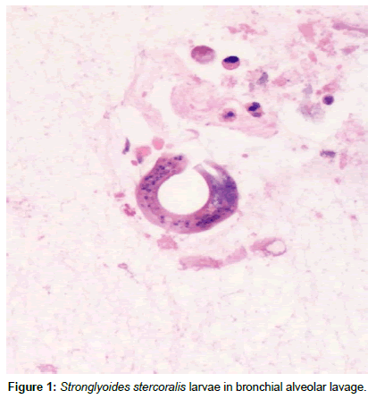 Medical-Microbiology-bronchial-alveolar