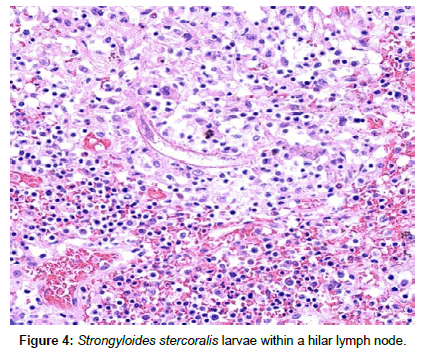 Medical-Microbiology-hilar-lymph