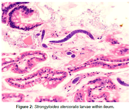 Medical-Microbiology-larvae-ileum