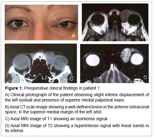 Ophthalmic-Pathology-clinical-findings