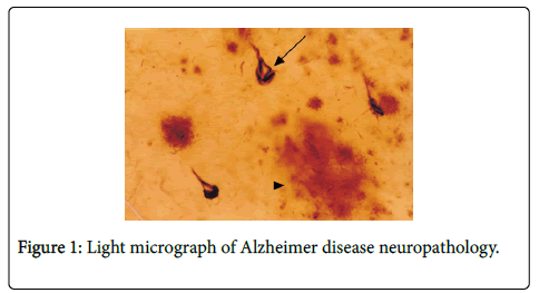 advanced-biomedical-Light-micrograph