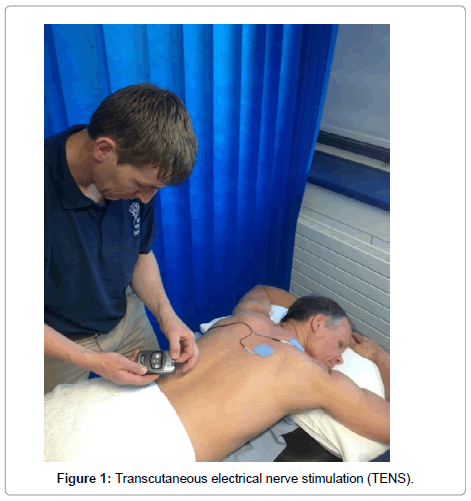 Transcutaneous Electrical Nerve Stimulators (TENS)