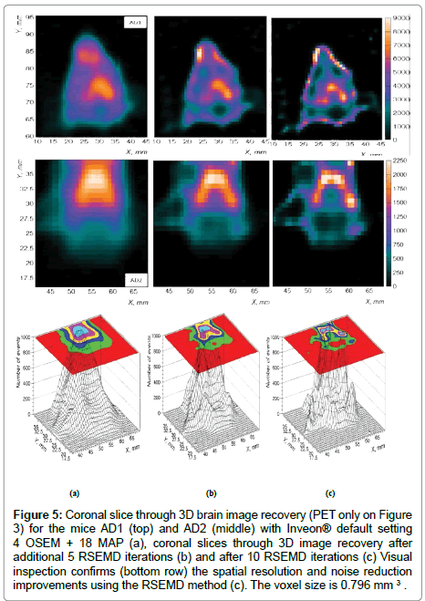 applied-bioinformatics-Coronal-slice
