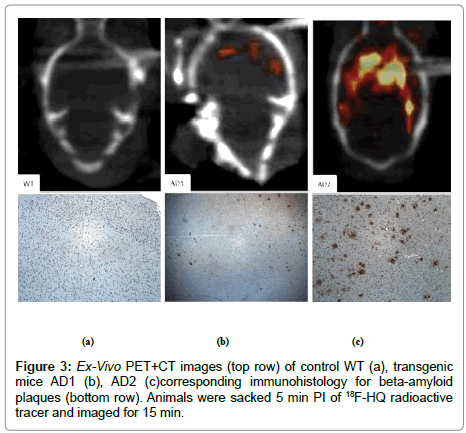 applied-bioinformatics-beta-amyloid