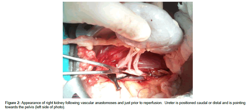 archives-transplantation-right-kidney