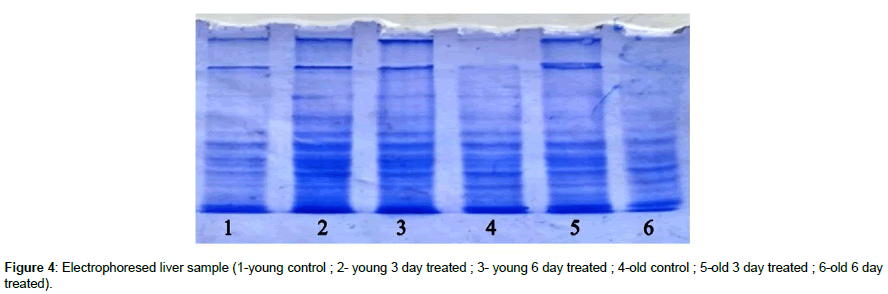 biochemical-bioprocess-engineering-Electrophoresed