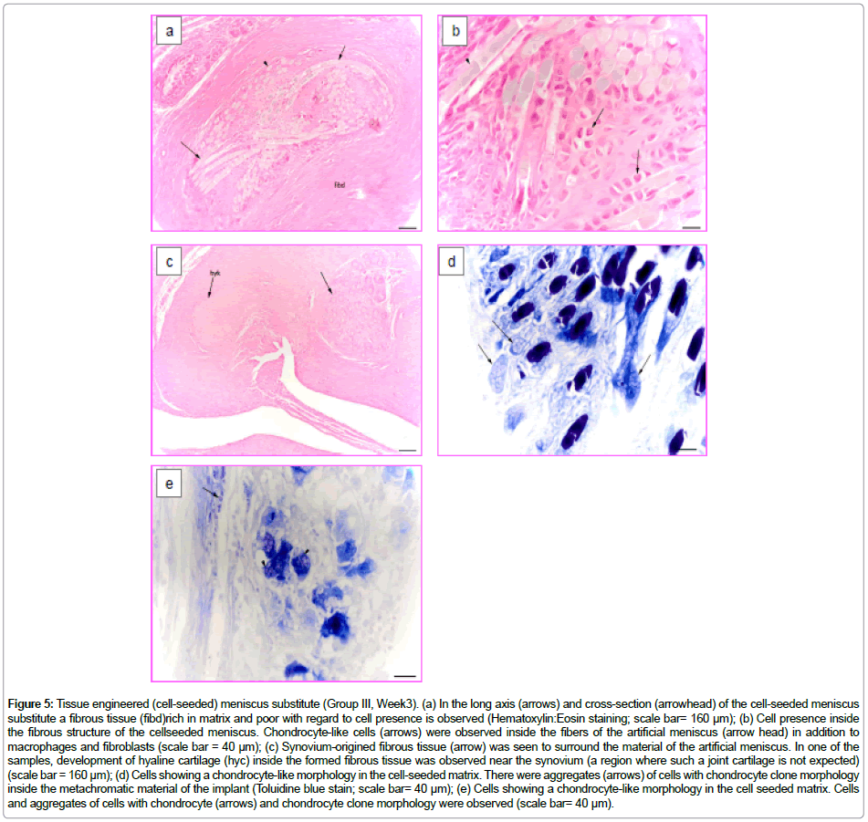 biomaterials-medical-Tissue-engineered