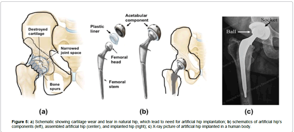 biomaterials-medical-applications-human