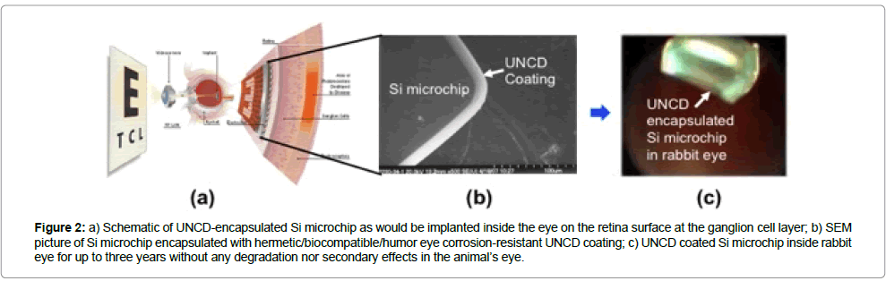 biomaterials-medical-applications-retina