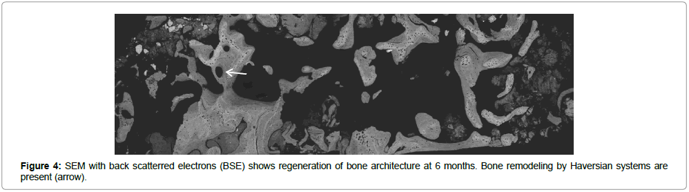 biomaterials-medical-applications-scatterred-electrons