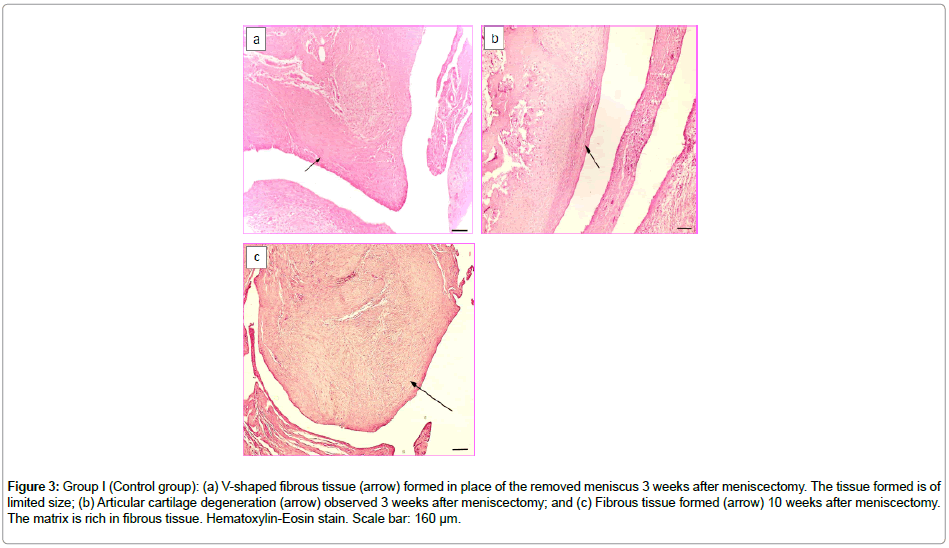 biomaterials-medical-fibrous-tissue