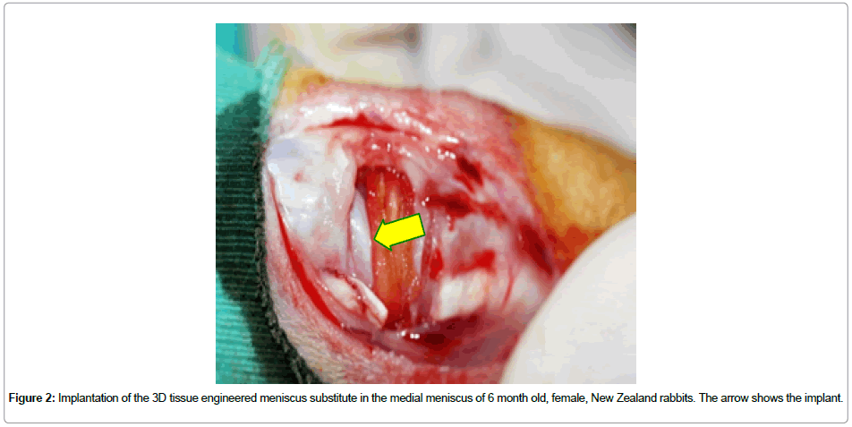 biomaterials-medical-medial-meniscus